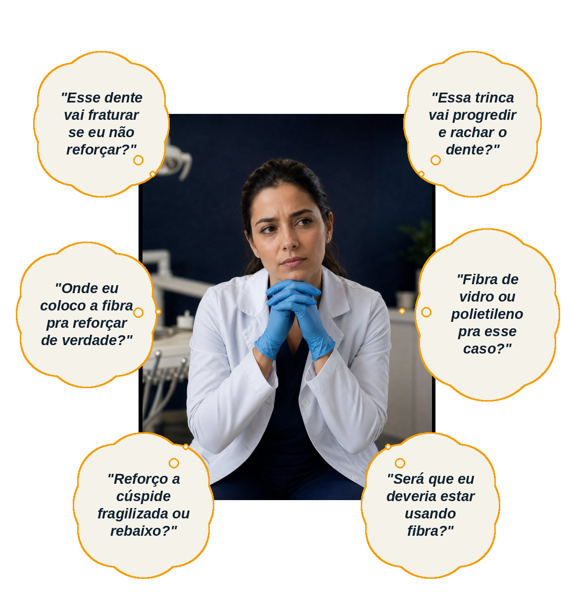 Dúvidas que travam o dentista: o dente vai fraturar? a trinca vai progredir? onde coloco a fibra? qual fibra usar? reforço ou rebaixo a cúspide? deveria estar usando fibra?
